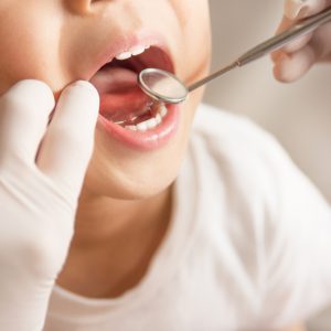 歯の悩みにサヨナラ！日本の歯科医院で受けるべき特別なメンテナンス